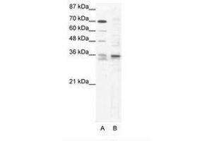 Image no. 1 for anti-SRY (Sex Determining Region Y)-Box 12 (SOX12) (C-Term) antibody (ABIN202223) (SOX12 抗体  (C-Term))