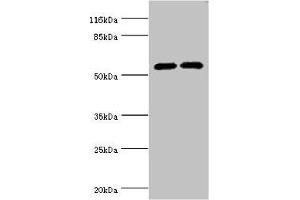 Western blot All lanes: CYP2E1 antibody at 12 μg/mL Lane 1: Jurkat whole cell lysate Lane 2: Mouse liver tissue Secondary Goat polyclonal to rabbit IgG at 1/10000 dilution Predicted band size: 57 kDa Observed band size: 57 kDa (CYP2E1 抗体  (AA 49-288))