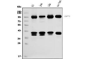 Western blot analysis of CDC27 using anti-CDC27 antibody (ABIN7602163).