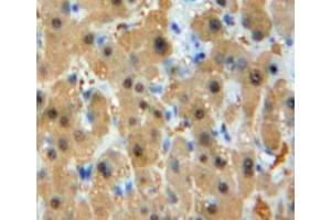 IHC-P analysis of liver tissuev, with DAB staining. (GSTM1 抗体  (AA 1-218))