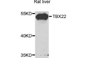 Western blot analysis of extracts of rat liver cells, using TBX22 antibody. (T-Box 22 抗体)