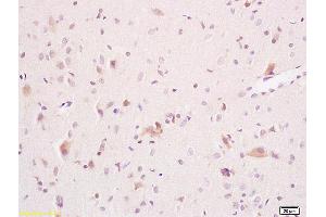 Formalin-fixed and paraffin embedded rat brain tissue labeled with Anti ARSA Polyclonal Antibody,Unconjugated (ABIN752428) at 1:200 followed by conjugation to the secondary antibody and DAB staining. (Arylsulfatase A 抗体  (AA 368-412))