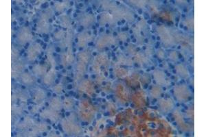 Detection of HSPBP1 in Rat Pancreas Tissue using Polyclonal Antibody to Heat Shock 70 kDa Binding Protein 1 (HSPBP1) (HSPBP1 抗体  (AA 198-352))