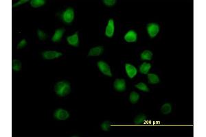 Immunofluorescence of purified MaxPab antibody to RAP1GDS1 on HeLa cell. (RAP1GDS1 抗体  (AA 1-607))