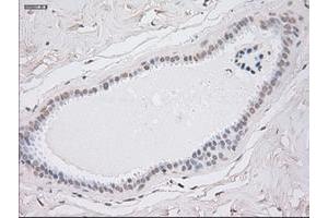 Immunohistochemistry (IHC) image for anti-Keratin 8 (KRT8) (AA 91-381) antibody (ABIN1491713)