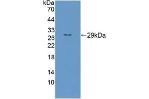 Detection of Recombinant RND1, Human using Polyclonal Antibody to Rho Family GTPase 1 (RND1) (RND1 抗体  (AA 1-229))