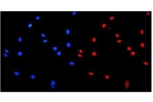 IF analysis of HnRNP A1 using anti-HnRNP A1 antibody (ABIN4886621). (HNRNPA1 抗体  (N-Term))
