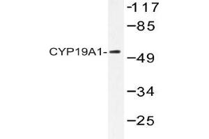 Western blot (WB) analysis of CYP19A1 Antibody in extracts from 293 cells. (Aromatase 抗体)