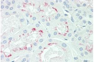 Human Kidney: Formalin-Fixed, Paraffin-Embedded (FFPE) (AQP3 抗体  (AA 163-191))
