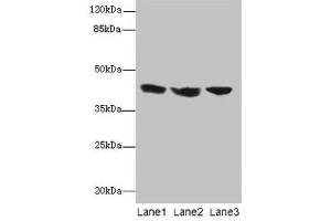 Western blot All lanes: IL2RG antibody at 12 μg/mL Lane 1: Jurkat whole cell lysate Lane 2: K562 whole cell lysate Lane 3: HL60 whole cell lysate Secondary Goat polyclonal to rabbit IgG at 1/10000 dilution Predicted band size: 43, 21 kDa Observed band size: 43 kDa (IL2RG 抗体  (AA 75-230))