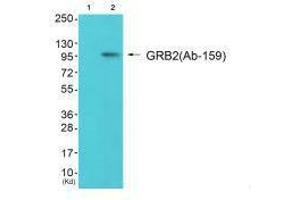 Western blot analysis of extracts from 293 cells (Lane 2), using Gab2 (Ab-159) antiobdy. (GAB2 抗体  (Ser159))