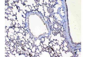IHC testing of FFPE mouse lung tissue with Factor D antibody at 1ug/ml. (Adipsin 抗体  (AA 26-263))