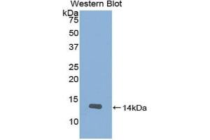 Western blot analysis of the recombinant protein. (SLIT2 抗体  (AA 1408-1519))