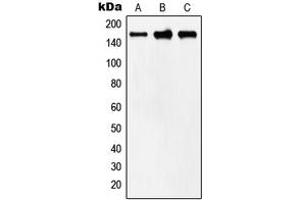 Western blot analysis of MYOM2 expression in human heart (A), mouse heart (B), rat heart (C) whole cell lysates. (MYOM2 抗体  (Center))