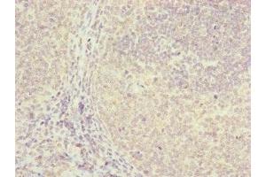 Immunohistochemistry of paraffin-embedded human tonsil tissue using ABIN7152411 at dilution of 1:100 (FBXO22 抗体  (AA 104-403))