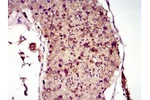 Immunohistochemical analysis of paraffin-embedded testis tissues using MAP1LC3A mouse mAb with DAB staining. (MAP1LC3A 抗体  (AA 1-121))