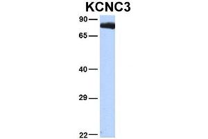Host:  Rabbit  Target Name:  KCNC3  Sample Type:  293T  Antibody Dilution:  1.