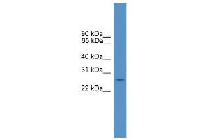 WB Suggested Anti-DLX4 Antibody Titration:  0. (DLX4 抗体  (N-Term))