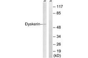 Western Blotting (WB) image for anti-Dyskeratosis Congenita 1, Dyskerin (DKC1) (AA 171-220) antibody (ABIN2889340) (DKC1 抗体  (AA 171-220))