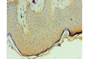 Immunohistochemistry of paraffin-embedded human skin tissue using ABIN7162697 at dilution of 1:100 (PNPLA3 抗体  (AA 377-481))