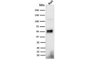 Western Blot Analysis of Raji cell lysate using CD79a Monoclonal Antibody (HM57). (CD79a 抗体  (AA 202-216))
