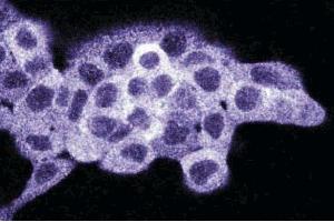 Immunofluorescence staining on A431 cells (Human epithelial carcinoma, ATCC CRL-1555). (Density Regulated Protein 抗体  (AA 19-201))