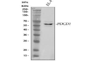 Western blot analysis of PDCD1 using anti-PDCD1 antibody (ABIN5518784). (PD-1 抗体  (N-Term))