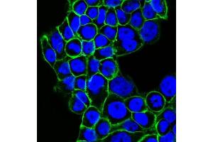 Confocal Immunofluorescent analysis of A431 cells using CF488-labeled EGFR Monoclonal Antibody (GFR450) (Green). (EGFR 抗体  (Extracellular Domain) (CF®488A))