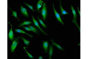 Immunofluorescence staining of Hela cells with ABIN7166420 at 1:66, counter-stained with DAPI. (PCMT1 抗体  (AA 117-228))