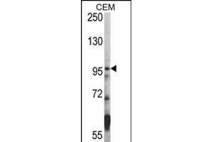 Western blot analysis of hHDAC7- (ABIN387957 and ABIN2844663) in CEM cell line lysates (35 μg/lane). (HDAC7 抗体  (C-Term))