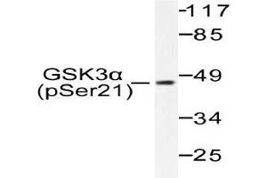 Western blot (WB) analysis of p-GSK3alpha antibody in extracts from ovary cancer.
