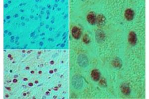 Image no. 1 for anti-Motor Neuron and Pancreas Homeobox 1 (MNX1) (AA 330-380) antibody (ABIN960266) (MNX1 抗体  (AA 330-380))