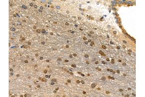 Phospho-AIRE (Ser156) Antibody at 1/100 staining Rat brain tissue by IHC-P. (AIRE 抗体  (pSer156))