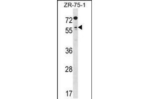 Western blot analysis in ZR-75-1 cell line lysates (35ug/lane). (TCFL5 抗体  (C-Term))