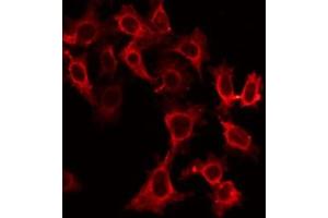 ABIN6266683 staining Hela by IF/ICC. (DR4 抗体)