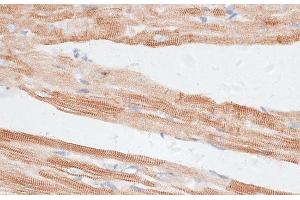 Immunohistochemistry of paraffin-embedded Rat heart using GRK5 Polyclonal Antibody at dilution of 1:100 (40x lens). (GRK5 抗体)