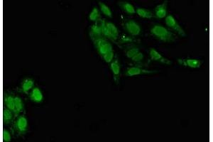 Immunofluorescent analysis of Hela cells using ABIN7164998 at dilution of 1:100 and Alexa Fluor 488-congugated AffiniPure Goat Anti-Rabbit IgG(H+L) (POT1 抗体  (AA 250-432))