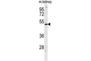 Western Blotting (WB) image for anti-Doublesex and Mab-3 Related Transcription Factor 3 (DMRT3) antibody (ABIN2995697) (DMRT3 抗体)