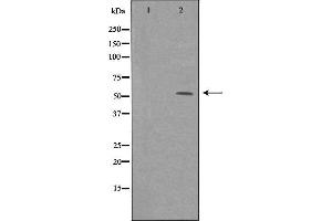 Western blot analysis of extracts from HeLa cells, using ME1 antibody. (ME1 抗体  (C-Term))