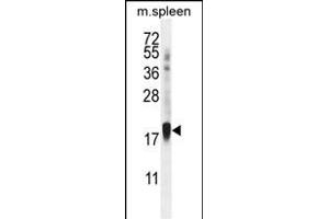 ZN Antibody (Center) (ABIN656018 and ABIN2845393) western blot analysis in mouse spleen tissue lysates (35 μg/lane). (ZNF593 抗体  (AA 62-88))