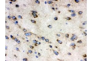 IHC testing of frozen mouse brain tissue with TCP1 antibody. (CCT4 抗体)