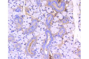 Immunohistochemistry of paraffin-embedded mouse thyroid using ROCK1 antibody (ABIN4905028) at dilution of 1:100 (40x lens).