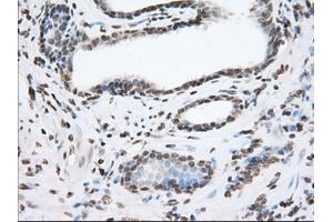 Immunohistochemical staining of paraffin-embedded Human liver tissue using anti-TACC3 mouse monoclonal antibody. (TACC3 抗体)