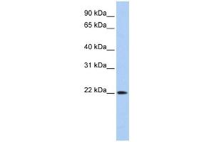 DNASE2B antibody used at 1 ug/ml to detect target protein.
