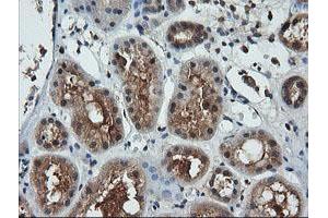 Image no. 3 for anti-Leucine Zipper and CTNNBIP1 Domain Containing (LZIC) antibody (ABIN1499239)