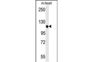Western blot analysis in mouse heart tissue lysates (15ug/lane). (KIF24 抗体  (N-Term))