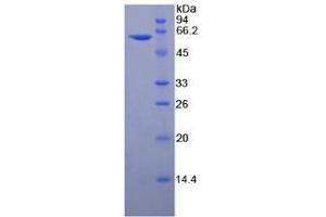 SDS-PAGE analysis of Rat Thrombospondin 4 Protein.
