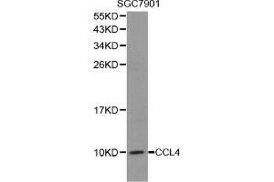 Western blot analysis of extracts of SGC7901 cell lines, using CCL4 antibody. (CCL4 抗体  (C-Term))