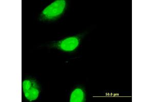 Immunofluorescence of monoclonal antibody to ALX1 on HeLa cell. (ALX1 抗体  (AA 198-306))