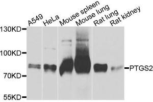 Western blot analysis of extracts of various cells, using PTGS2 antibody. (PTGS2 抗体)